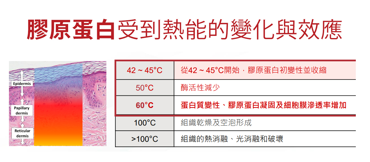 海芙電波_海芙電波Volnewmer_電音雙波_電波價格_電波拉皮_電波推薦_醫美電波_韓國電波價格_電波拉提_恆麗美型_最新電波_08