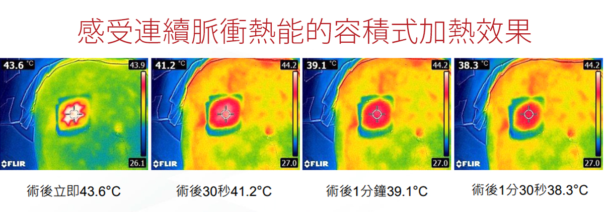 海芙電波_海芙電波Volnewmer_電音雙波_電波價格_電波拉皮_電波推薦_醫美電波_韓國電波價格_電波拉提_恆麗美型_最新電波_09